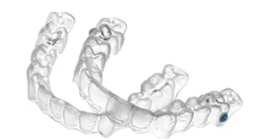 Aligner Therapie – durchsichtige Schienen - Dr. Lutz Hodecker - Zahnarzt Wien 1010