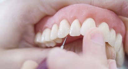 Hochästhetische Prothetiklösungen