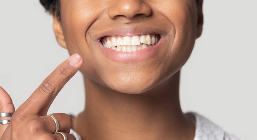 Professionelle Mundhygiene - Dr. Robert Stillmann, MSc - Zahnarzt Wien 1190