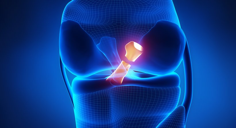 Knie - Kreuzbandriss - Univ.-Prof. Dr. Stefan Marlovits - Orthopäde Wien 1190
