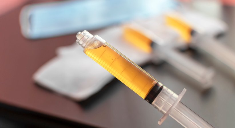 PRP (Platelet Rich Plasma Therapie) und Blutplasmatherapie – Eigenbluttherapie - Univ.-Prof. Dr. Stefan Marlovits - Orthopäde Wien 1190