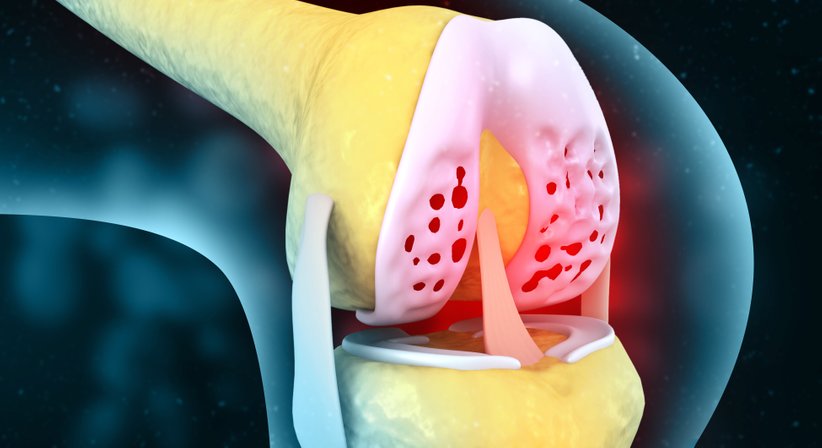 Knorpel und Gelenke – moderne Knorpelchirurgie - Univ.-Prof. Dr. Stefan Marlovits - Orthopäde Wien 1190