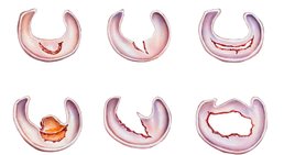 Univ.-Prof. Dr. Stefan Marlovits - Orthopäde Wien 1190