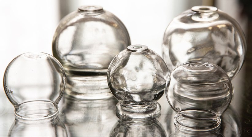 Schröpfen - Dr. Marietta Coloini - Praktische Ärztin Wien 1090