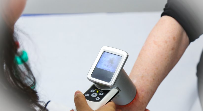 Dermatologische Behandlung - Dr. med. univ. Hanaa Hasan, FEBDV - Hautärztin Wien 1050