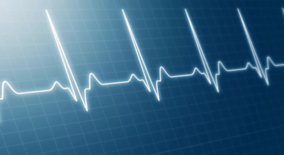 Herzrhythmusstörungen