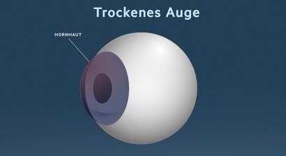 Trockenes Auge