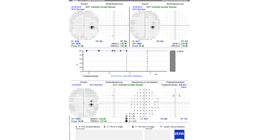 Grüner Star (Glaukom)  - Prof. Dr. Dr.  Nikolaus Luft, FEBO, FWCRS - Augenarzt Wien 1010