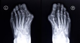 Dr. Andreas Gfrerrer, MSc - Orthopäde Stockerau 2000