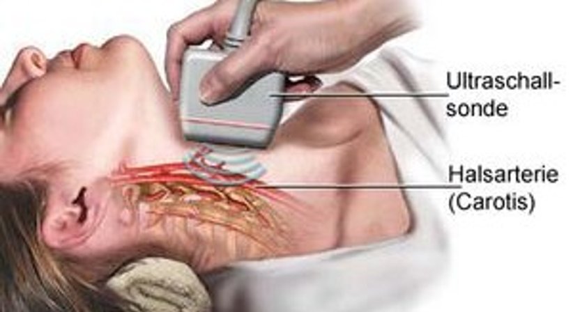 Carotisultraschall - OA Dr. Daniel Stückler - Internist Neuzeug 4523
