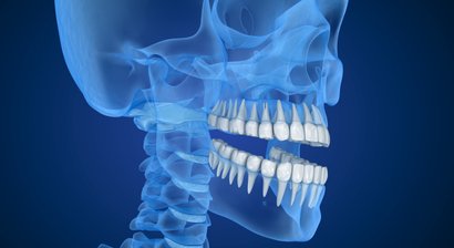 Digitale Zahntechnik / DVT Volumentomographie