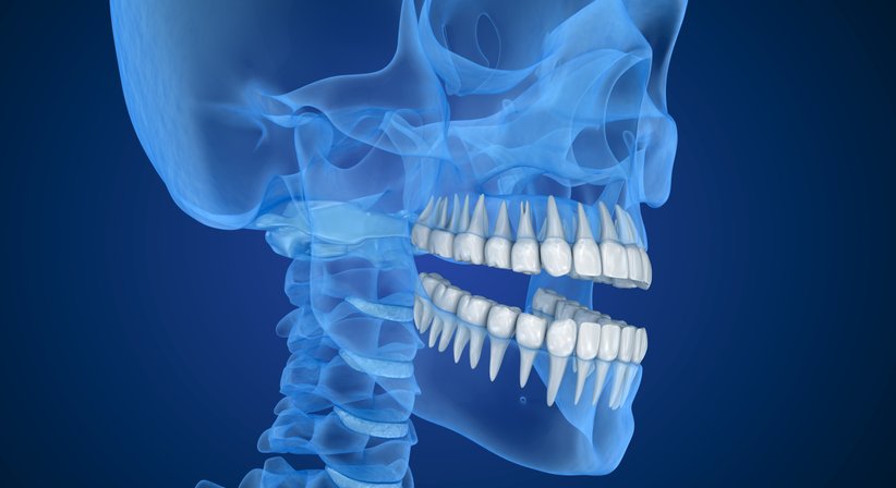Digitale Zahntechnik / DVT Volumentomographie - Dr. med. dent. Timea Wicker - Zahnärztin Wien 1010