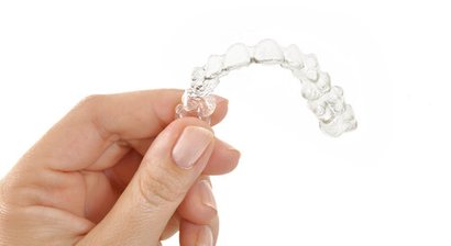 Unsichtbare Zahnspange / Alignertherapie