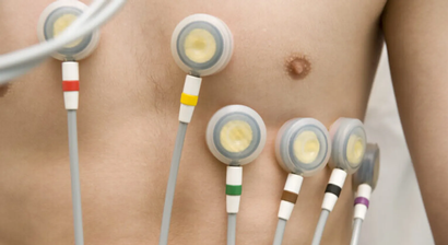 Vorsorgeuntersuchungen