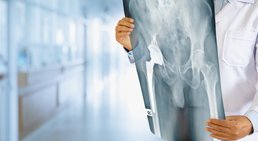 Prim.a.D. Priv.-Doz. Dr. med. univ. Roman Radl, MBA - Orthopäde Graz 8010