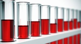 Prim.a.D. Priv.-Doz. Dr. med. univ. Roman Radl, MBA - Orthopäde Graz 8010