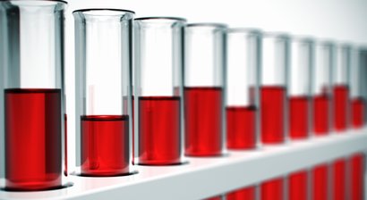 Eigenblutbehandlung (PRP-Therapie)