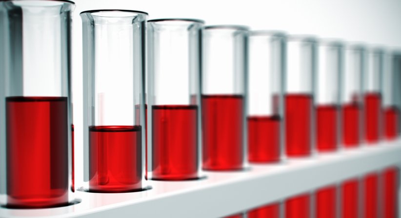 Eigenblutbehandlung (PRP-Therapie) - Prim.a.D. Priv.-Doz. Dr. med. univ. Roman Radl, MBA - Orthopäde Graz 8010