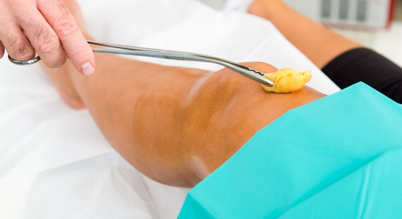 Operative Arthrosetherapie - Prim.a.D. Priv.-Doz. Dr. med. univ. Roman Radl, MBA - Orthopäde Graz 8010