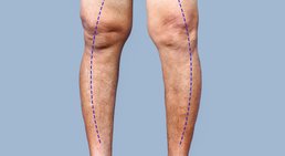 Prim.a.D. Priv.-Doz. Dr. med. univ. Roman Radl, MBA - Orthopäde Graz 8010