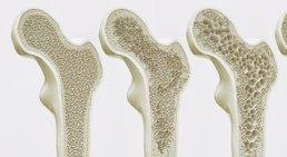 Prim.a.D. Priv.-Doz. Dr. med. univ. Roman Radl, MBA - Orthopäde Graz 8010