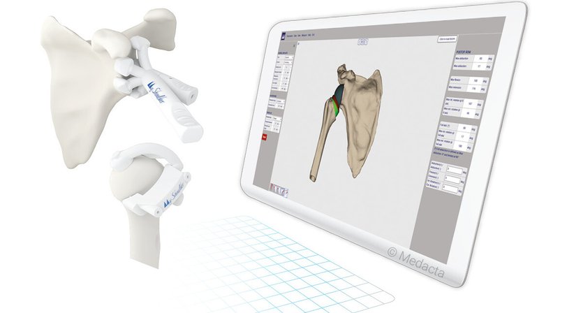 Schultergelenkprothese - OA Dr. Markus Riedl - Orthopäde Wien 1190