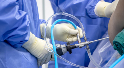 Schulterarthroskopie