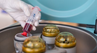 Eigenbluttherapie (ACP)