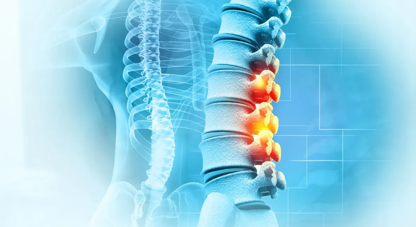 Gezielte Infiltration bei Rückenschmerzen  - OA Dr. Markus Riedl - Orthopäde Wien 1190
