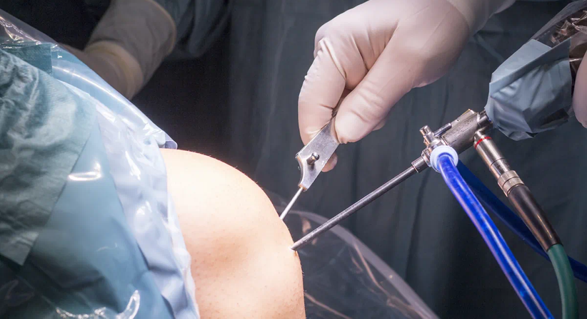 Kniearthroskopie (Meniskus etc.) - OA Dr. Markus Riedl - Orthopäde Wien 1190