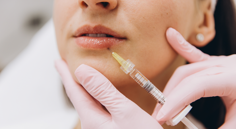 Hyaluronsäure oder Biostimulator Behandlung (Lippen/Gesicht) - Dr. Peter Pumberger - Plastischer Chirurg Salzburg 5020