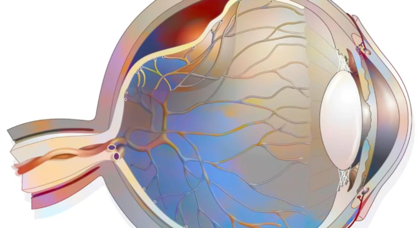 Laserchirurgie der Netzhaut - Oberarzt Dr. Reza Fazeli - Augenarzt Wien 1040