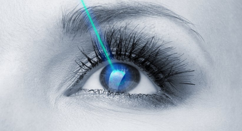 Refraktive Laserkorrekturen von Fehlsichtigkeiten - Priv.-Doz. Dr. Jan Lammer - Augenarzt Wien 1190