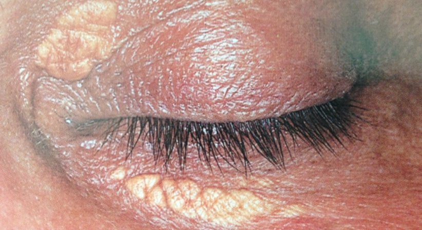 Ästhetische Dermatologie - Dr. Ulrike Wieland - Hautärztin Salzburg 5020