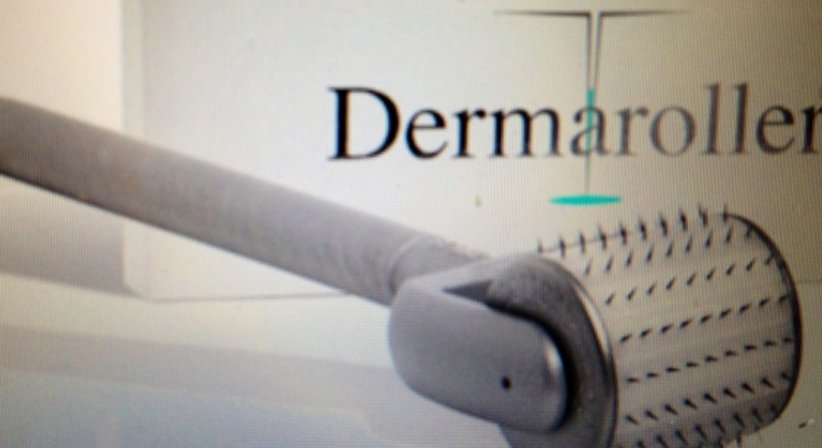 Ästhetische Dermatologie - Dr. Ulrike Wieland - Hautärztin Salzburg 5020
