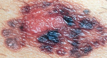 Ambulante Operationen