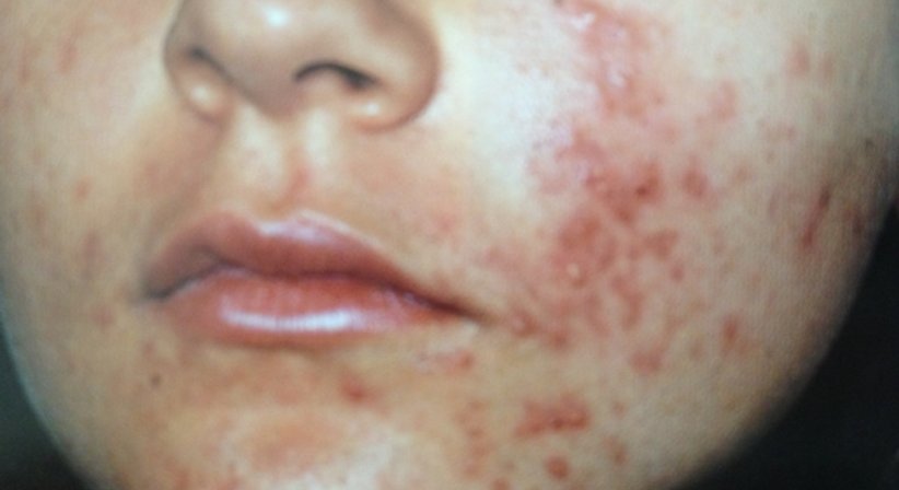 Klassische Dermatologie - Dr. Ulrike Wieland - Hautärztin Salzburg 5020