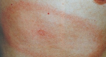 Klassische Dermatologie