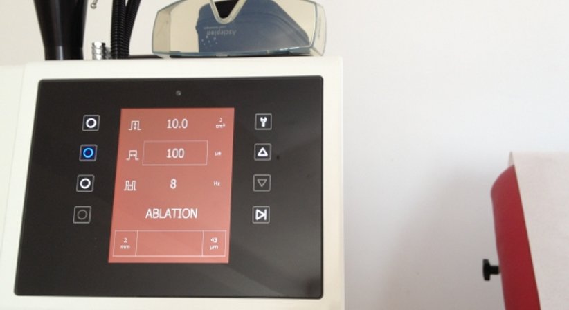 Laserbehandlung - Dr. Ulrike Wieland - Hautärztin Salzburg 5020