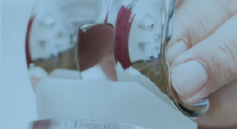Arthrose - Dr. Jürgen Barthofer - Unfallchirurg Linz 4020