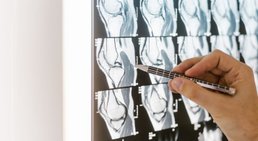 Praxis - Prim. Priv.-Doz. DDr. Christian Albrecht, MBA - Orthopäde Wien 1080