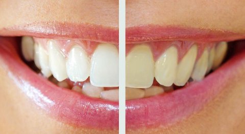 Praxis - Dr. Franz Atzlinger jr. - Zahnarzt Thalheim bei Wels 4600