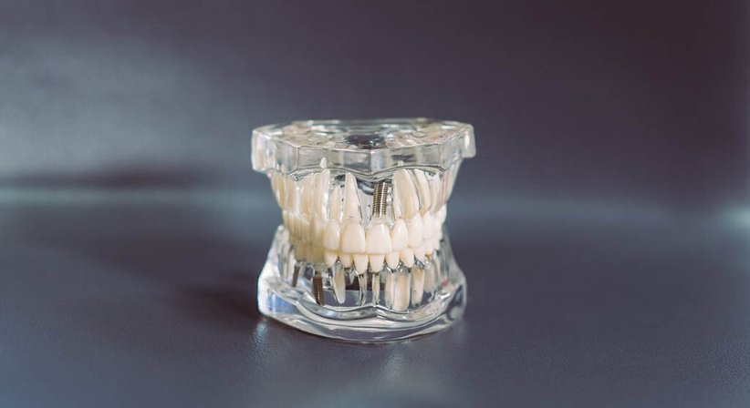 Dr. Franz Atzlinger jr. - Zahnarzt Thalheim bei Wels 4600