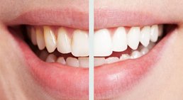 Dr. Franz Atzlinger jr. - Zahnarzt Thalheim bei Wels 4600