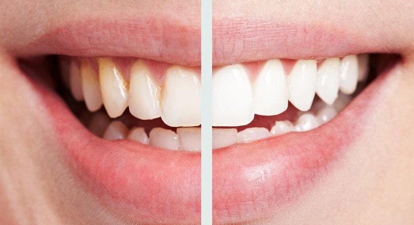 Dr. Franz Atzlinger jr. - Zahnarzt Thalheim bei Wels 4600