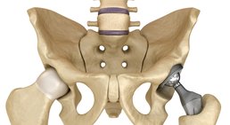 Dr. Michael Messenbäck - Orthopäde 3100 St. Pölten