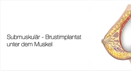 Univ.Doz. Dr. Artur Worseg - Plastischer Chirurg Wien 1190