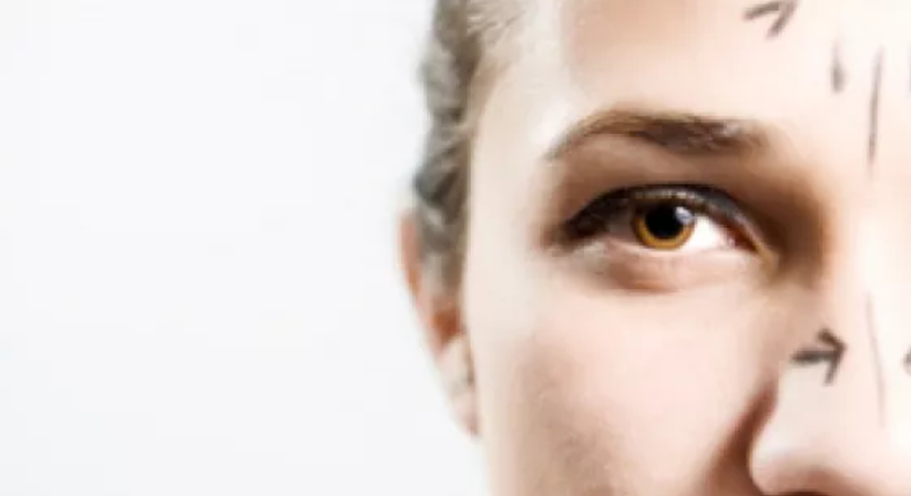 Botox - Univ.Doz. Dr. Artur Worseg - Plastischer Chirurg Wien 1010