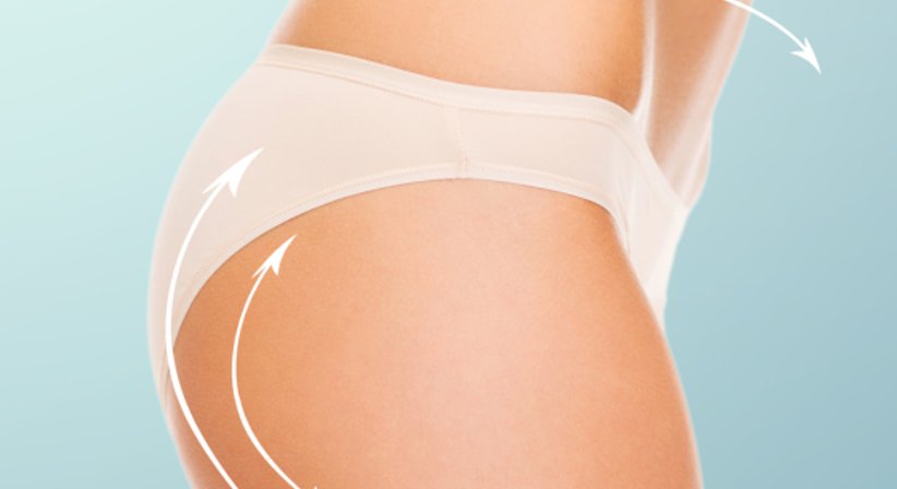 Hautstraffung - Priv.-Doz. Dr. Johannes Matiasek - Plastischer Chirurg Wien 1010