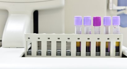 PRP-Therapie (Eigenblutbehandlung)